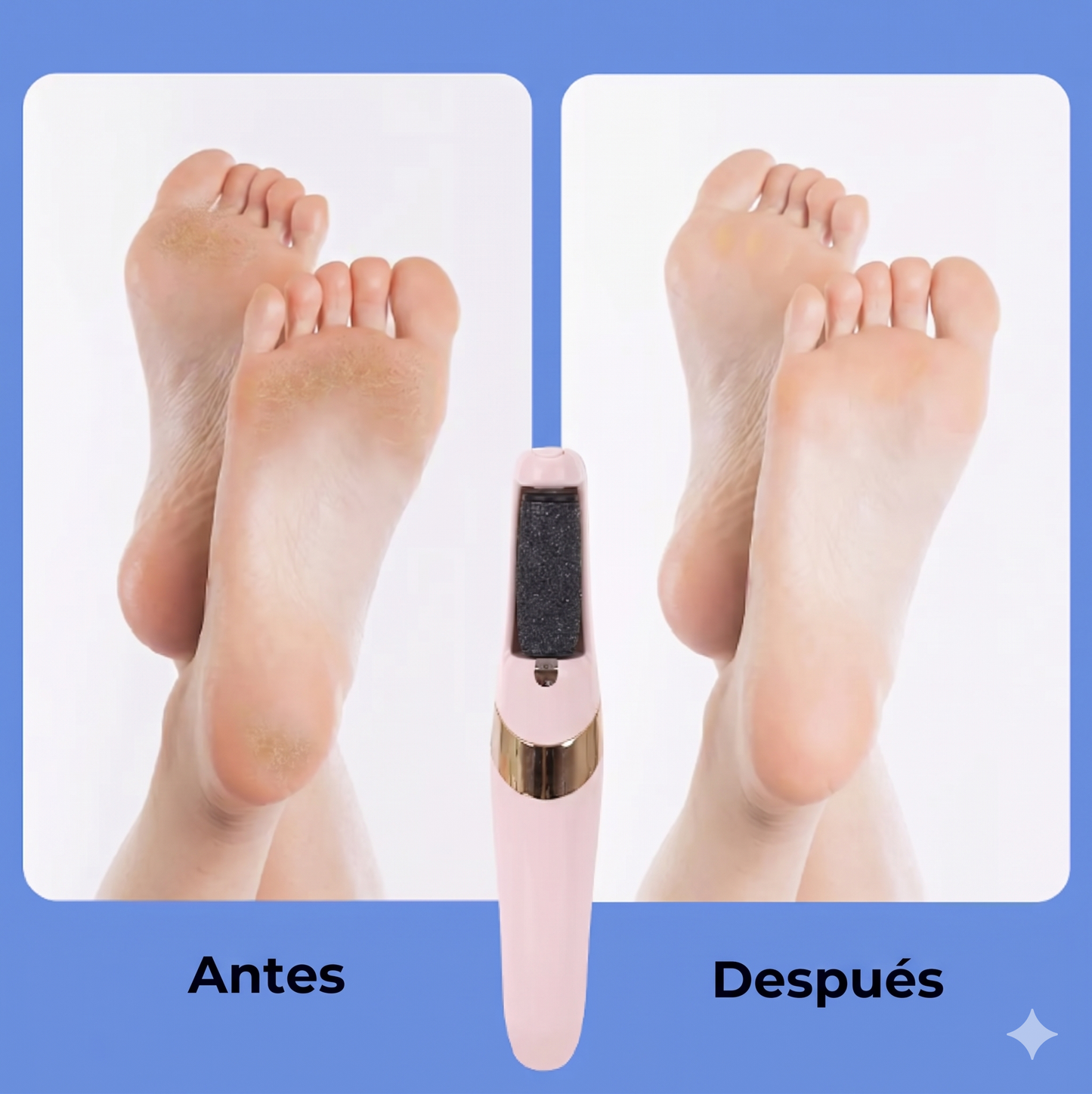 Lumina Sole - Removedor de Callos Eléctrico Recargable